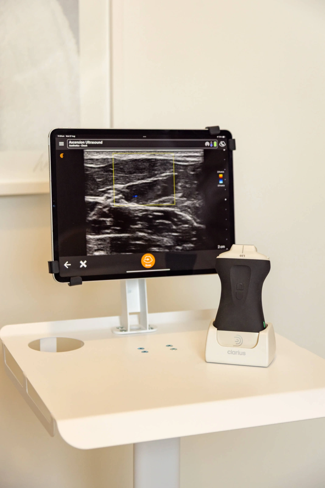 Tablet displaying live scan results during ultrasound guided aesthetics with handheld probe ready for accurate facial imaging.
